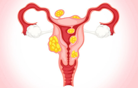 ������ �������� ��������� ���� �����