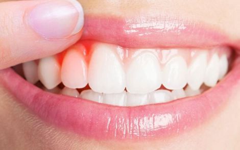 ������, �� ������� ��� ��������� ������� ������� �������