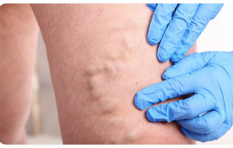 ������� �������� ����������� ���������� ���