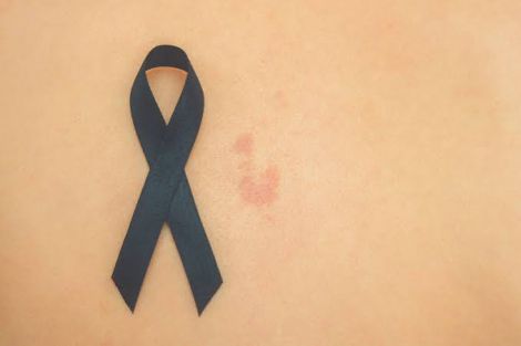 Вакцина проти раку від Moderna успішно пройшла масштабні випробування Вакцина проти раку від Moderna успішно пройшла масштабні випробування