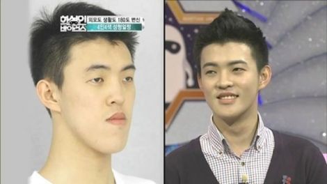 before_and_after_photos_of_korean_plastic_surgery_008.jpg (18.14 Kb)