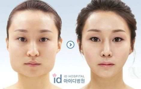 before_and_after_photos_of_korean_plastic_surgery_025.jpg (17.85 Kb)